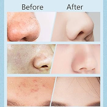 Pore cleaner with camera