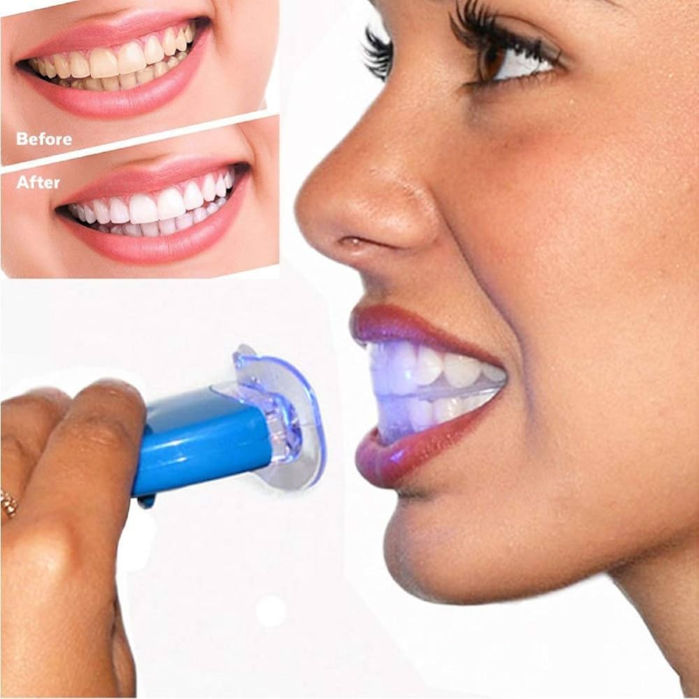 Teeth whitening kit